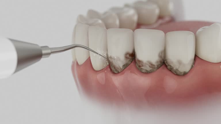 Trusted Teeth Cleaning And Checkup service in Riverbank, CA - Dentist Open Now